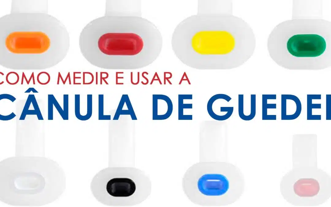 canula de guedel